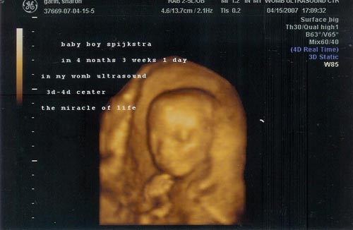 4dscan.jpg